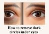 how to remove dark circles : కళ్ళ క్రింది నల్లటి వలయాలు ఎలా తొలగించాలి How to remove dark circles under eyes
