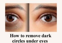 how to remove dark circles : కళ్ళ క్రింది నల్లటి వలయాలు ఎలా తొలగించాలి How to remove dark circles under eyes