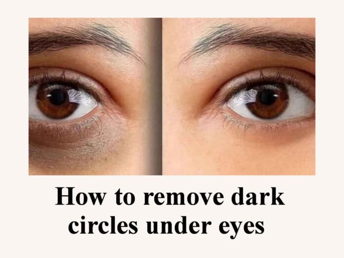 How to remove dark circles under eyes